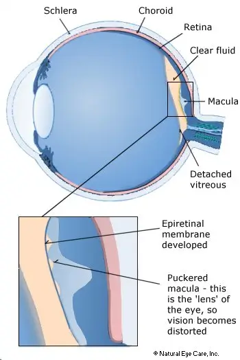 eye-x-section-back-of-eye