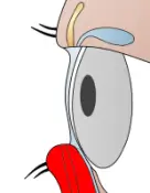 eyelid