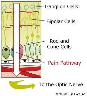 light-sensitivity