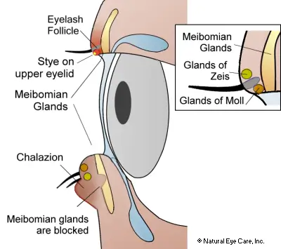 meibomian